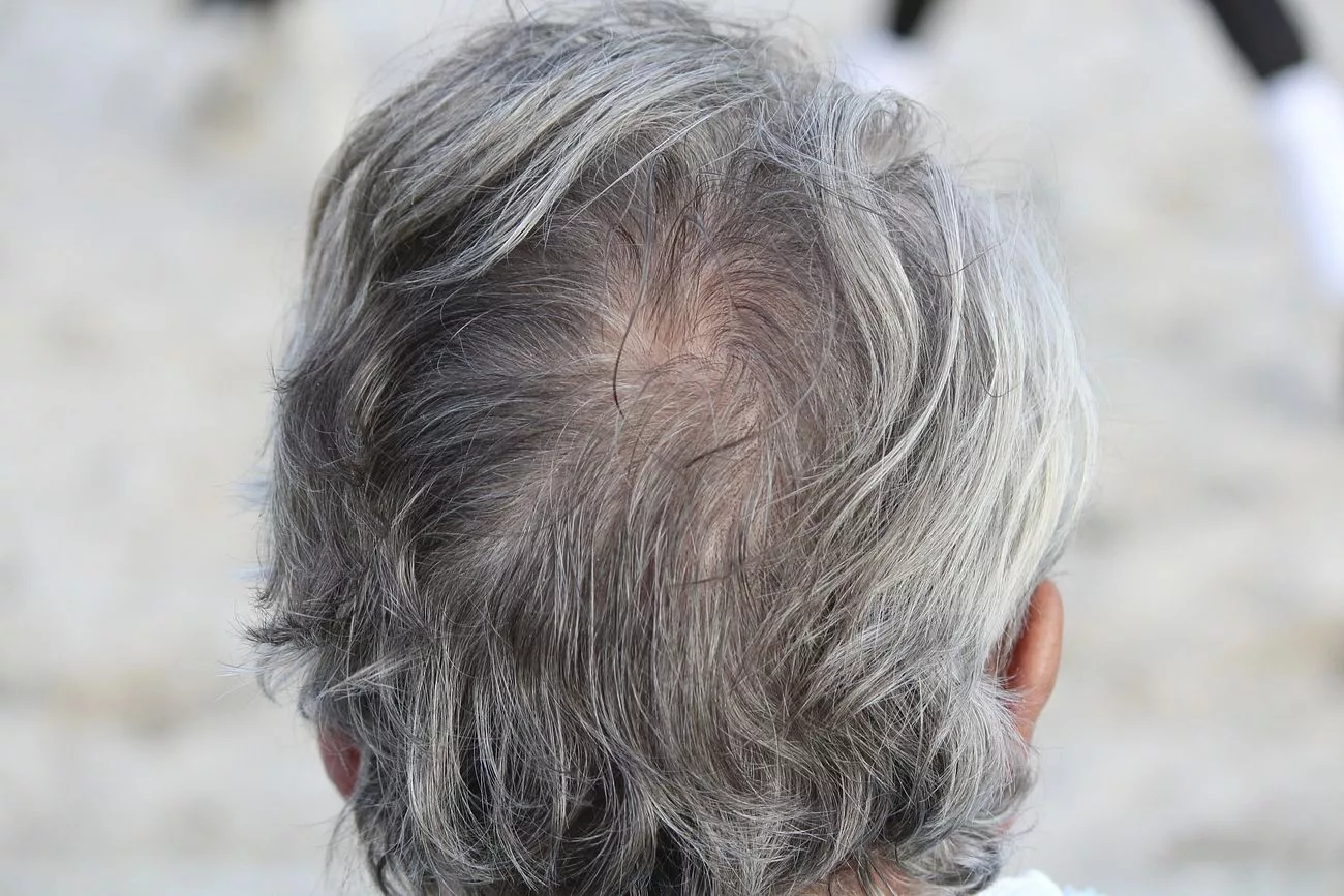 Gray hair on man